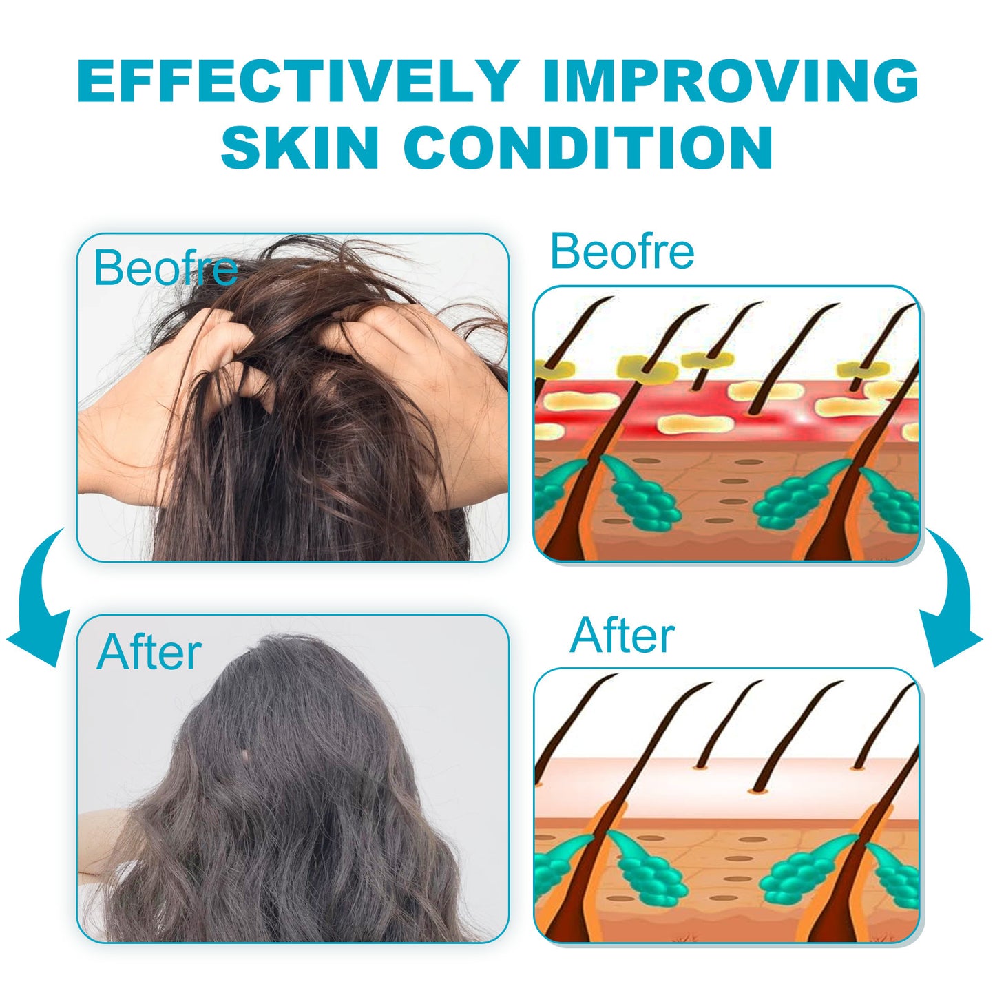 Seborrheic Dermatitis & Psoriasis Shampoo