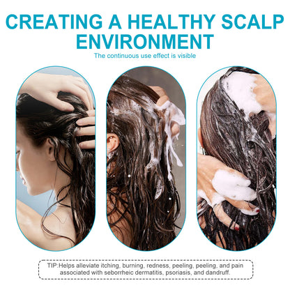 Seborrheic Dermatitis & Psoriasis Shampoo